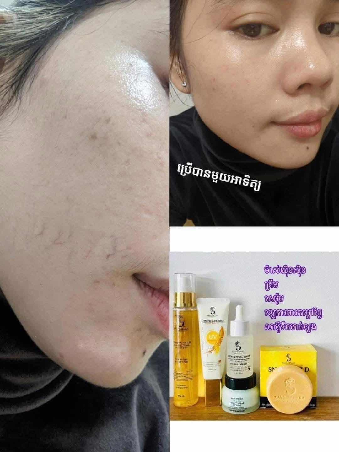 Serum គុជខ្យង យិនស៊ីន