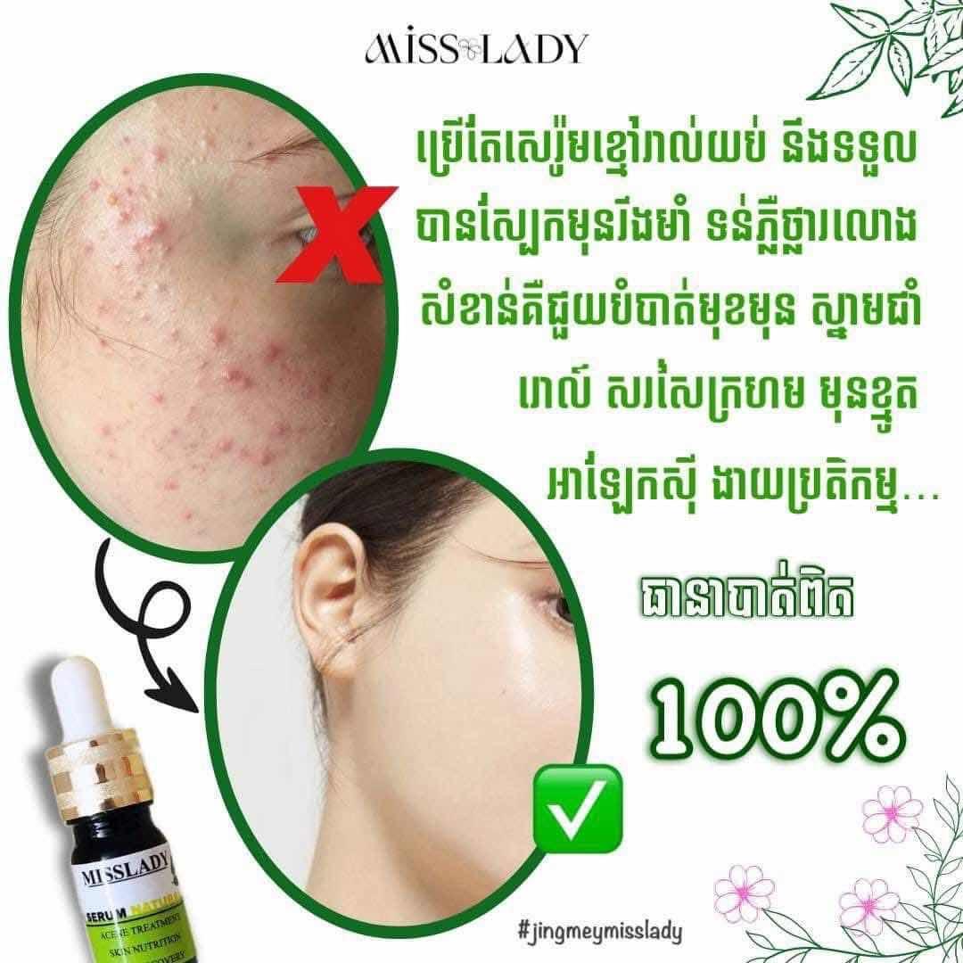 សេរ៉ូម Miss lady (ខ្មៅ)