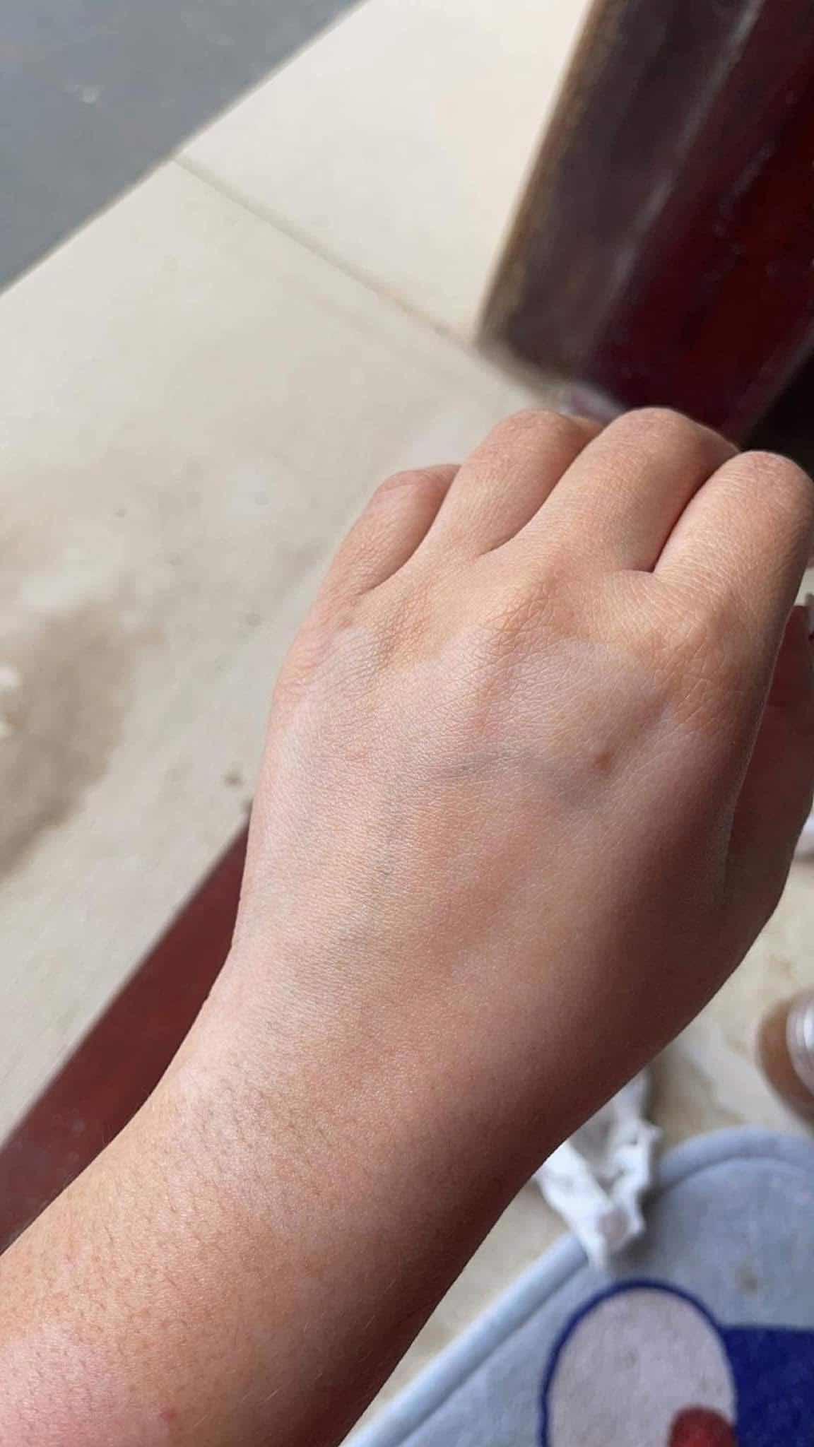 Spa body skin