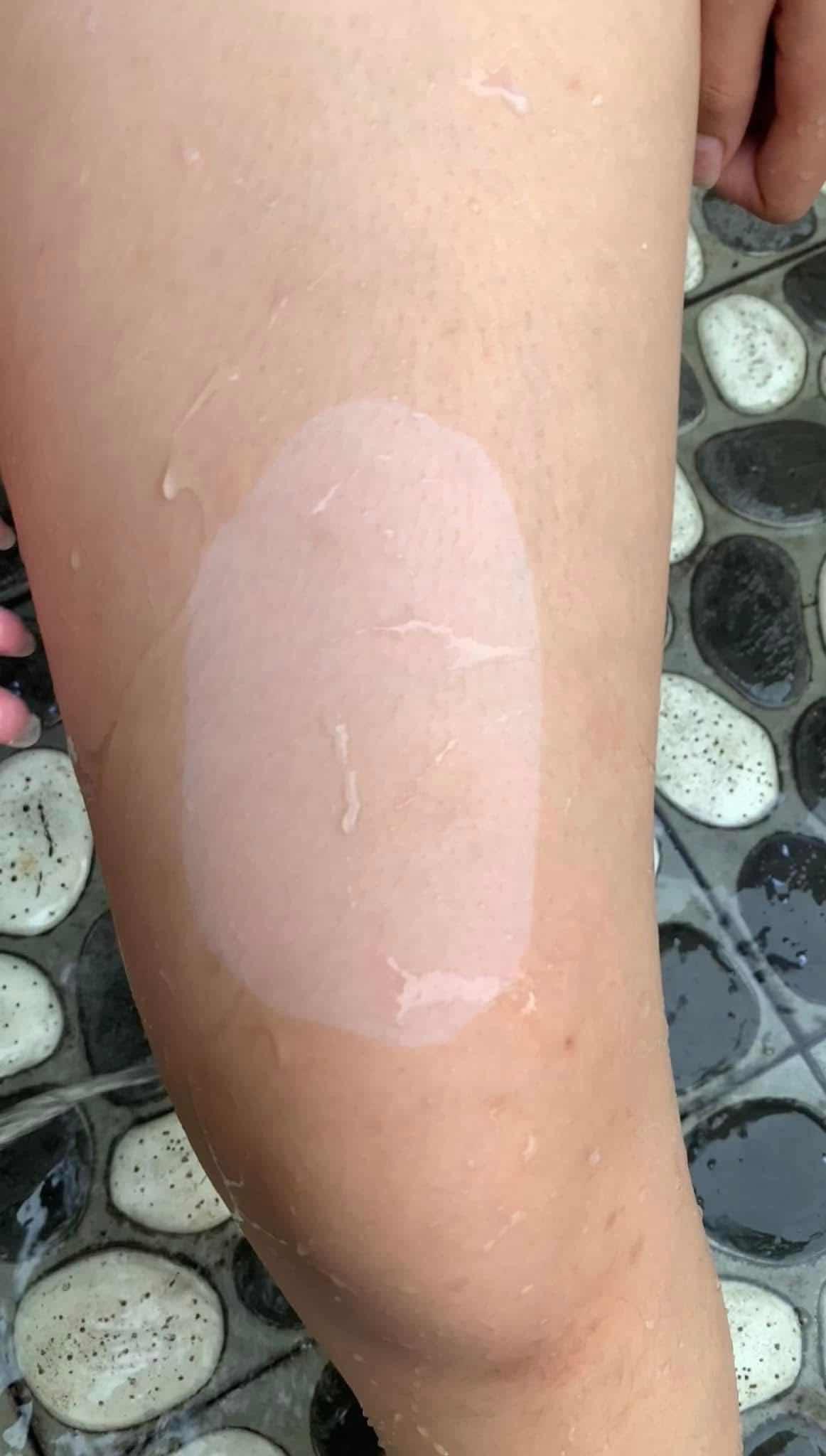 Spa body skin